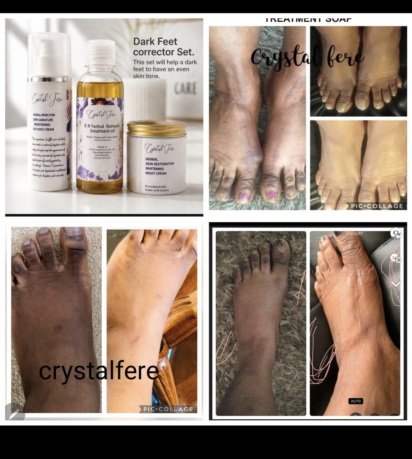 DARK FEET CORRECTOR SET.