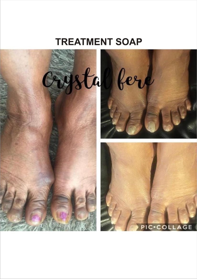 Skin treatment butter - crystalfere collectiblecrystalfere collectible