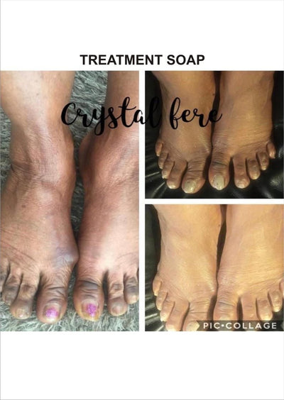 Skin treatment butter - crystalfere collectiblecrystalfere collectible