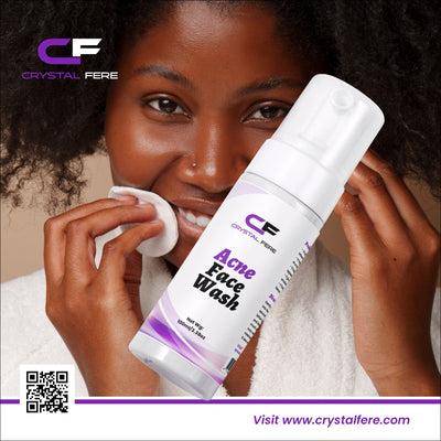 Acne Face Wash - crystalfere collectibleCrystal fere
