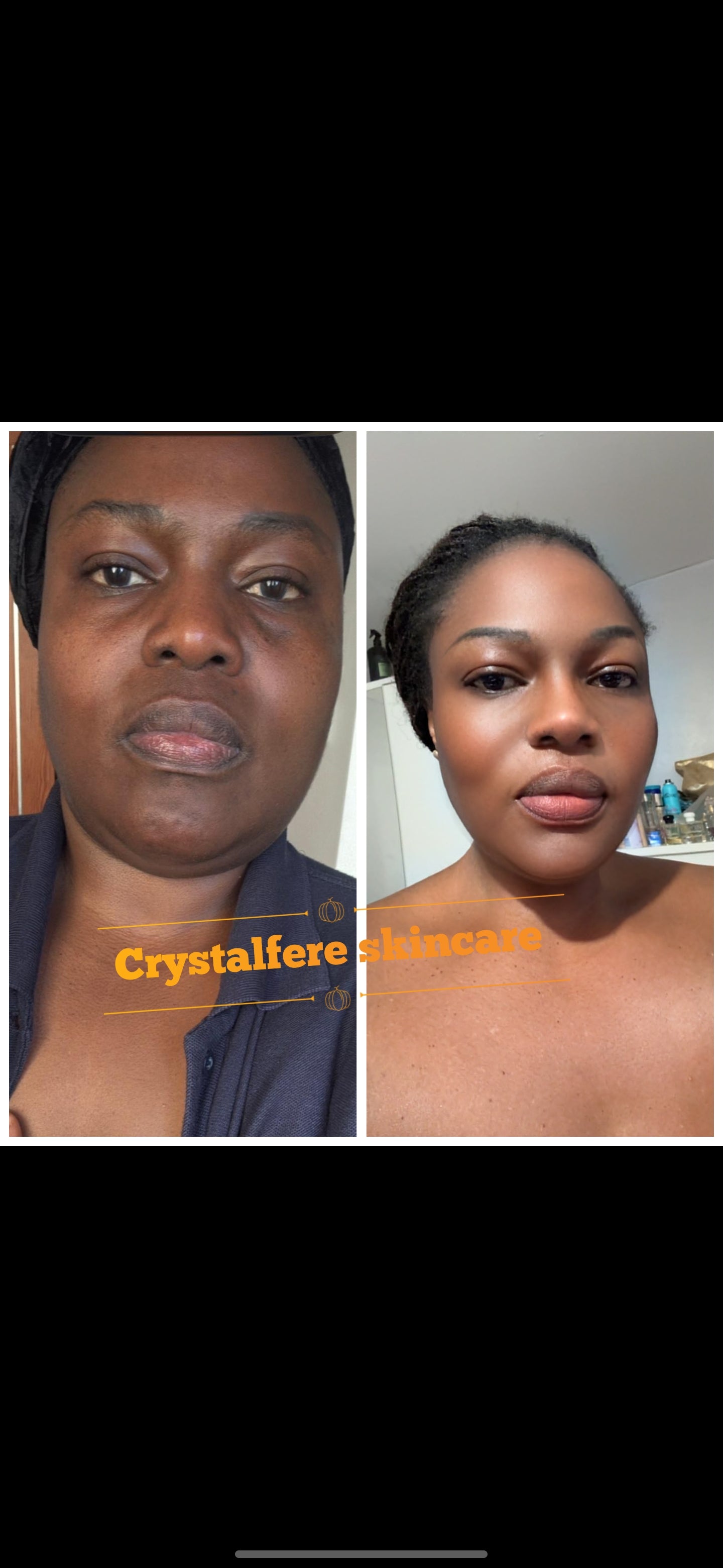 Skin therapy mauntainance beauty face and body set.hydrating lotion and repair oil, day face cream night face cream and facial mask. Good for skun maintainance. You will achieve a radiant, glowing and beighter complatiin.